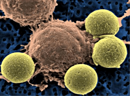 limfocyty_by_microbe_world