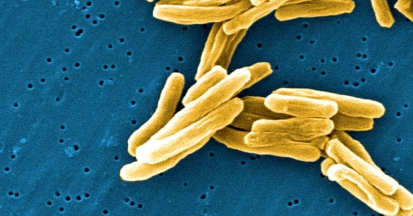 gram-positive-mycobacterium-tuberculosis-bacteria