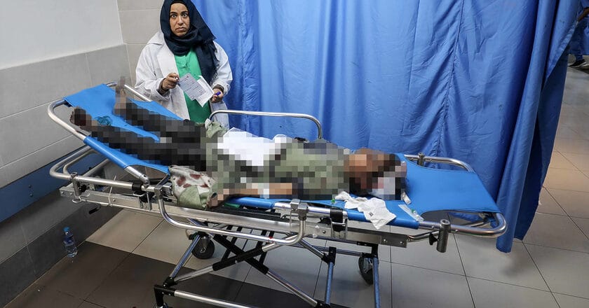 Palestyńskie dziecko ranne po izraelskim ataku w szpitalu Al-Szifa w mieście Gaza. Fot. Palestinian News & Information Agency (Wafa) in contract with APAimages
